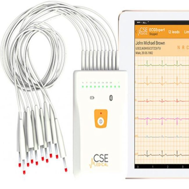 mobilus elektrokardiografas e1504872293823